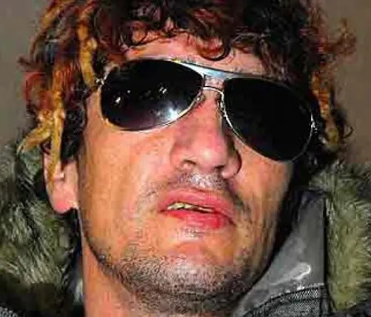 Pity lvarez - El cantante de Intoxicados choc con su moto
